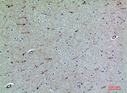 Immunohistochemistry validation of SELPLG using Anti-PSGL-1 SELPLG Antibody (A03674)