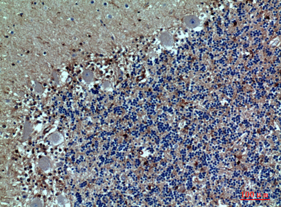 Immunohistochemistry validation of SELPLG using Anti-PSGL-1 SELPLG Antibody (A03674)