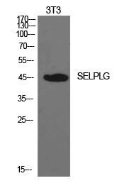 Western blotting validation for Anti-PSGL-1 SELPLG Antibody A03674
Western Blot (WB) analysis of NIH-3T3 cells using PSGL-1 polyclonal antibody