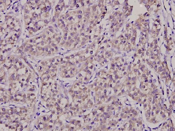a03678 1 surf1 primary antiboties ihc testing 2