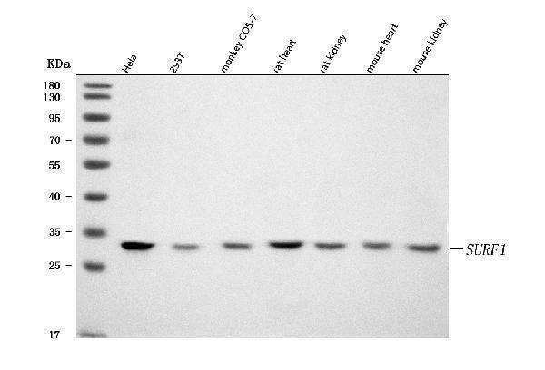 Western blot analysis of SURF1 using anti-SURF1 antibody (A03678-2)
