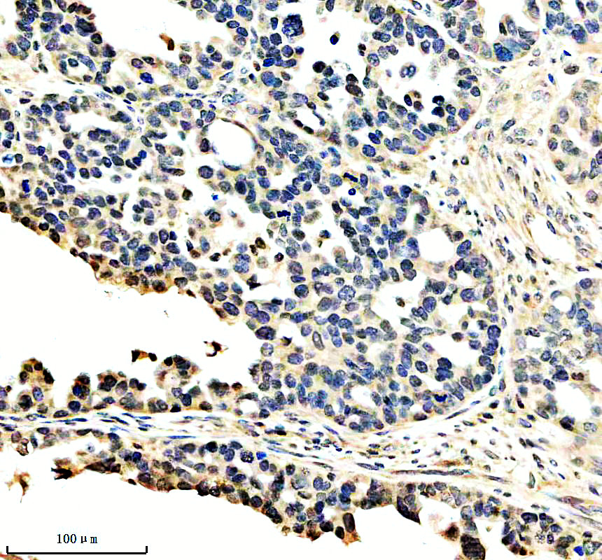 IHC analysis of MAML2 using anti-MAML2 antibody (A03679-1)