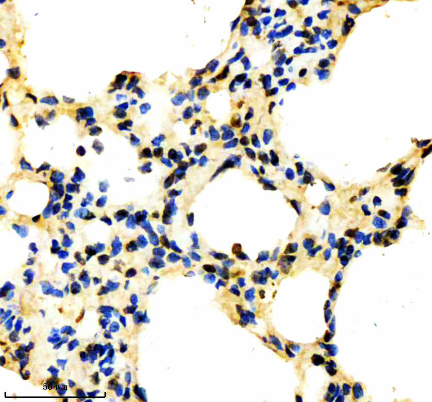 IHC analysis of MAML2 using anti-MAML2 antibody (A03679-1)