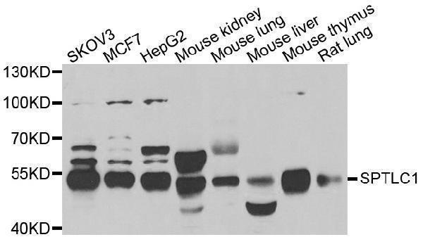 WesternBlot (WB) analysis of SPTLC1 polyclonal antibody
