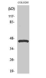Western Blot analysis of various cells using SR-4 Polyclonal Antibody