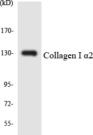 Western blot analysis of the lysates from 293 cells using Collagen I α2 antibody
