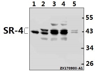 Western blot (WB) analysis of SR-4 (D47) pAb at 1:500 dilution
Lane1:CT26 whole cell lysate(40ug)
Lane2:C6 whole cell lysate(40ug)
Lane3:HEK293T whole cell lysate(40ug)
Lane4:K562 whole cell lysate(40ug)
Lane5:U-87MG whole cell lysate(40ug)