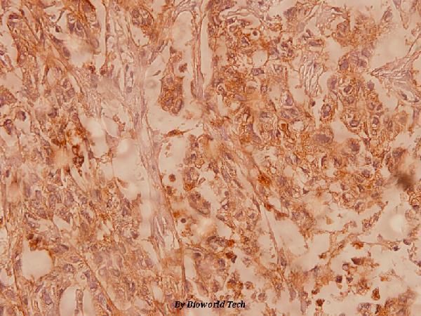 a03683 1 cldn4 primary antiboties ihc testing 2