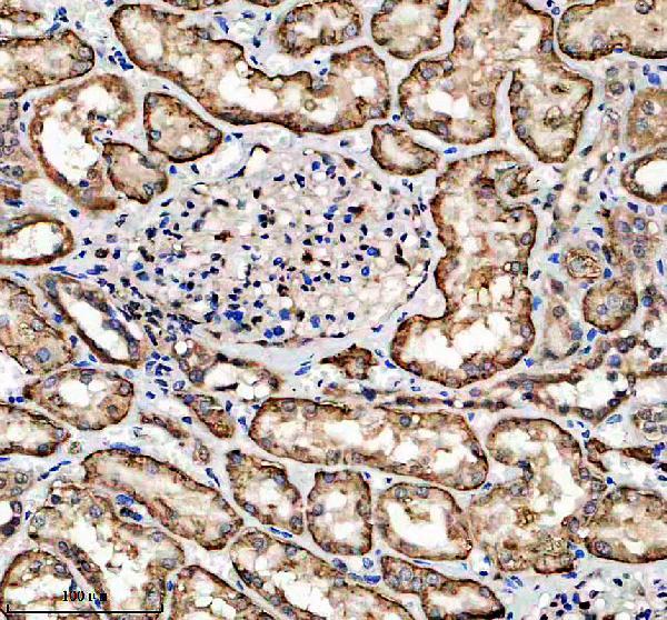IHC analysis of Claudin 4/CLDN4-Specific using anti-Claudin 4/CLDN4-Specific antibody (A03683-2)