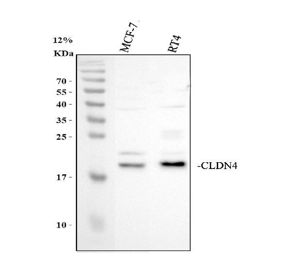 Western blot analysis of Claudin 4/CLDN4-Specific using anti-Claudin 4/CLDN4-Specific antibody (A03683-2)