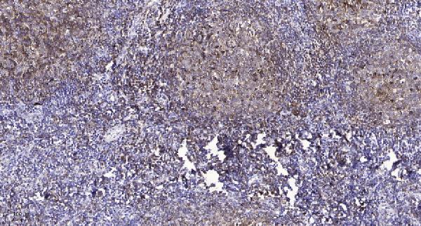 a03683y208 1 cldn4 primary antibodies ihc testing 1