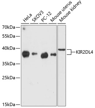 a03685 kir2dl4 primary antiboties wb testing 1