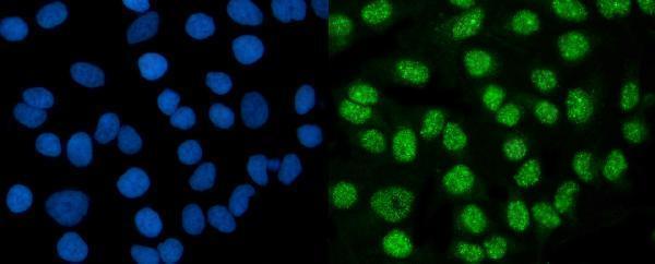  IF analysis of DMAP1 using anti-DMAP1 antibody (A03688-2)