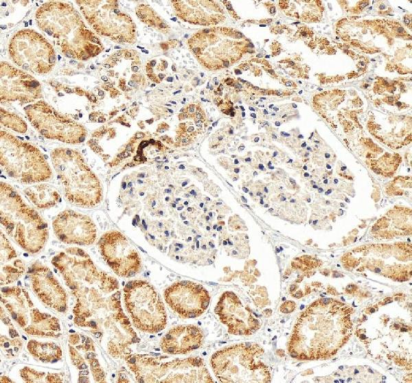 a03689 2 ren primary antibodies ihc testing 2