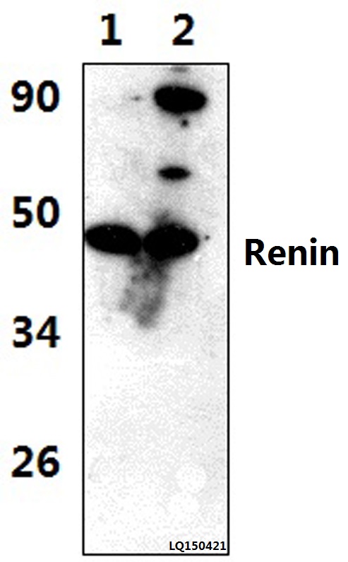 a03689 ren primary antiboties wb testing 1