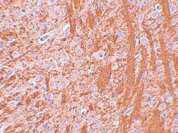 Immunohistochemistry of JMJD6 in rat brain tissue with JMJD6 antibody at 2