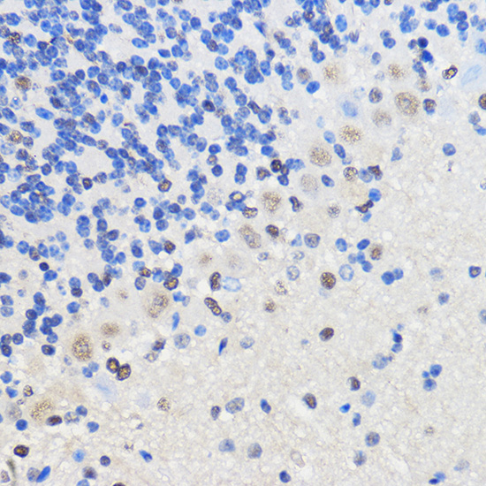 Immunohistochemistry of paraffin-embedded Mouse brain using hnRNP U Rabbit pAb  at dilution of 1:50 