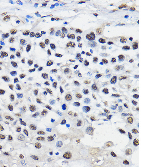 a03691 1 hnrnpu primary antiboties ihc testing 4