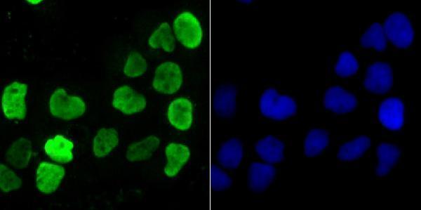 ICC staining HnRNP U in A431 cells (green)