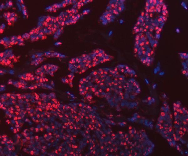 a03691 3 hnrnpu primary antibodies if testing 14