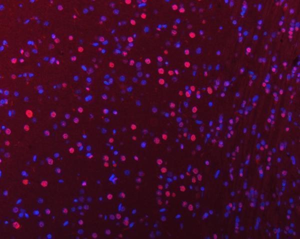 a03691 3 hnrnpu primary antibodies if testing 15