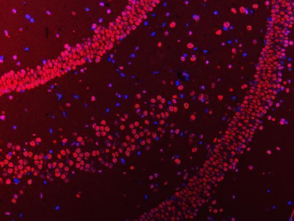 a03691 3 hnrnpu primary antibodies if testing 16