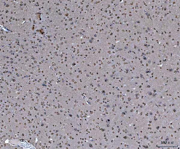 a03691 3 hnrnpu primary antibodies ihc testing 10