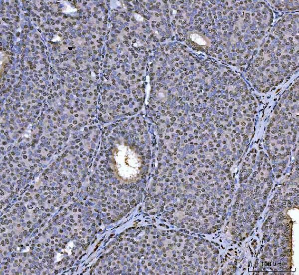  IHC analysis of hnRNP U/p120/HNRNPU using anti-hnRNP U/p120/HNRNPU antibody (A03691-3)