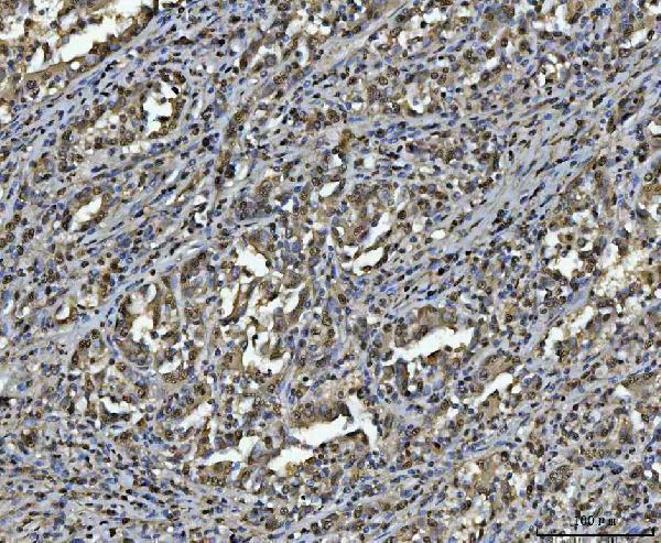  IHC analysis of hnRNP U/p120/HNRNPU using anti-hnRNP U/p120/HNRNPU antibody (A03691-3)