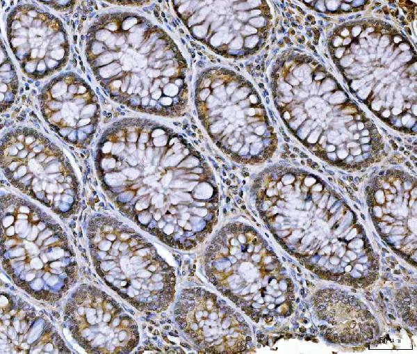 a03691 3 hnrnpu primary antibodies ihc testing 4
