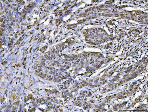 a03691 3 hnrnpu primary antibodies ihc testing 5