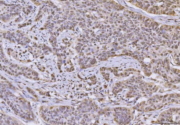 a03691 3 hnrnpu primary antibodies ihc testing 6