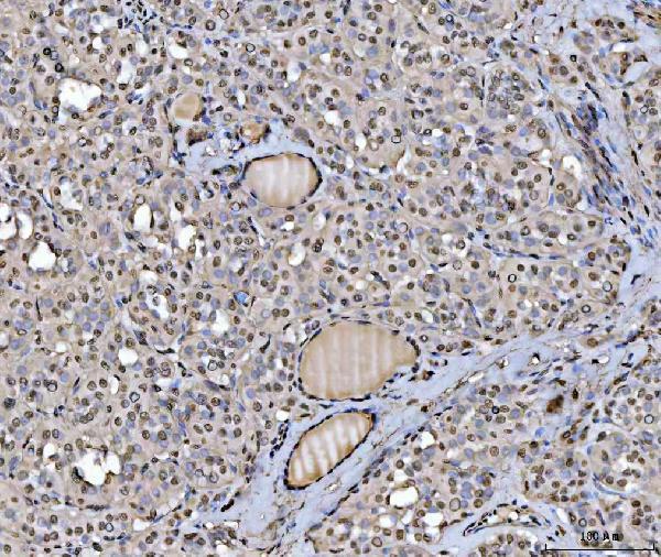 a03691 3 hnrnpu primary antibodies ihc testing 7