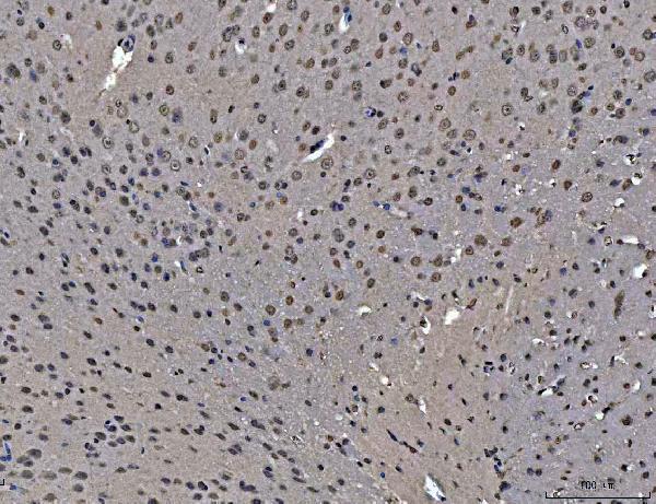 a03691 3 hnrnpu primary antibodies ihc testing 9