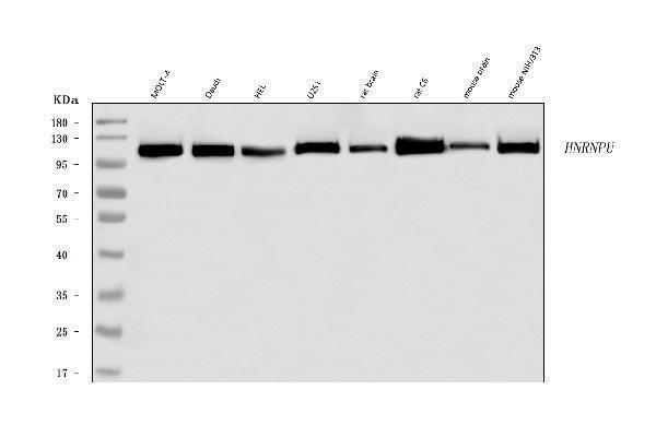  Western blot analysis of hnRNP U/p120/HNRNPU using anti-hnRNP U/p120/HNRNPU antibody (A03691-3)