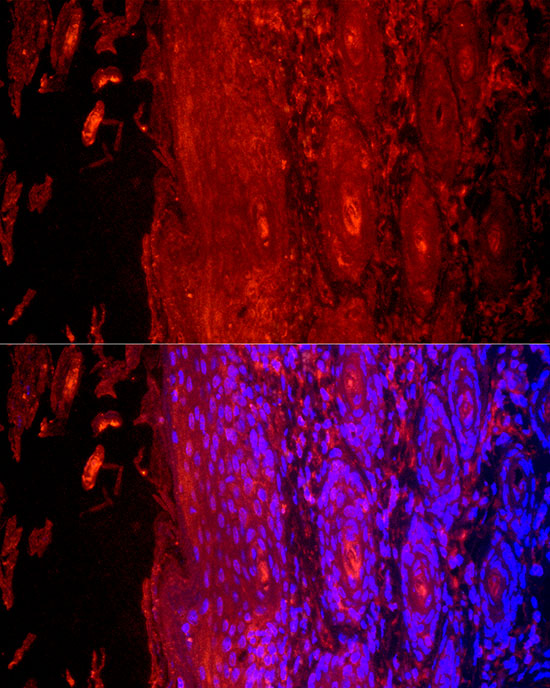 Immunofluorescence analysis of human skin cells using Cytokeratin 9  Rabbit pAb  at dilution of 1:200 
