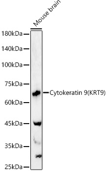 Western blot analysis of Mouse brain, using Cytokeratin 9  antibody  at  1:2140 dilution