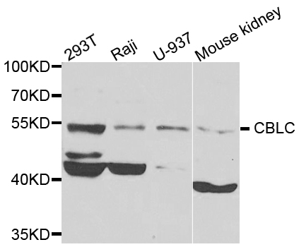 a03693 1 cblc primary antiboties wb testing 1