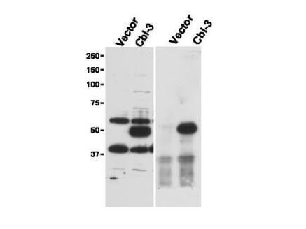 Immunoprecipitation (right) and western blot (left) using Boster's Affinity Purified anti-Cbl-c antibody shows detection of a predominant band at ~52 kDa corresponding to Cbl-c