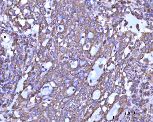  IHC analysis of RPS14 using anti-RPS14 antibody (A03696-1)
