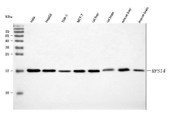  Western blot analysis of RPS14 using anti-RPS14 antibody (A03696-1)