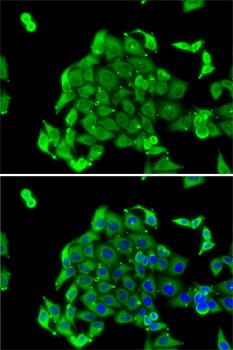 Immunofluorescence analysis of MCF7 cells using RPS14 antibody 