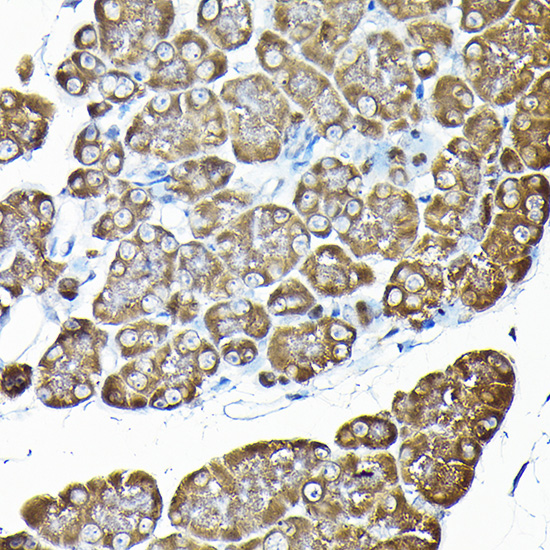 Immunohistochemistry of paraffin-embedded rat pancreas using RPS14 Rabbit pAb  at dilution of 1:200 