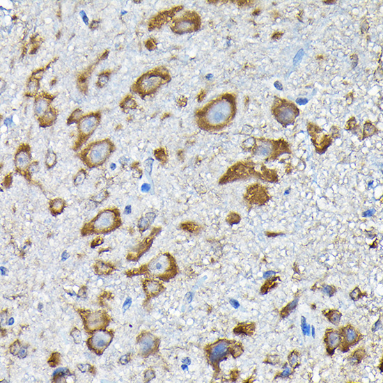 a03696 rps14 primary antiboties ihc testing 3