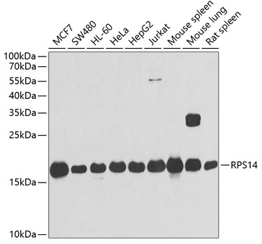 Western blot analysis of extracts of various cell lines, using RPS14 antibody  at 1:1000 dilution