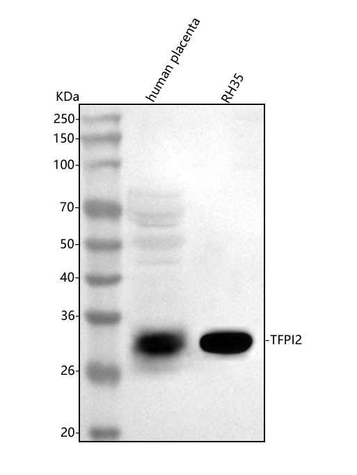  Western blot analysis of TFPI2 using anti-TFPI2 antibody (A03697-2)