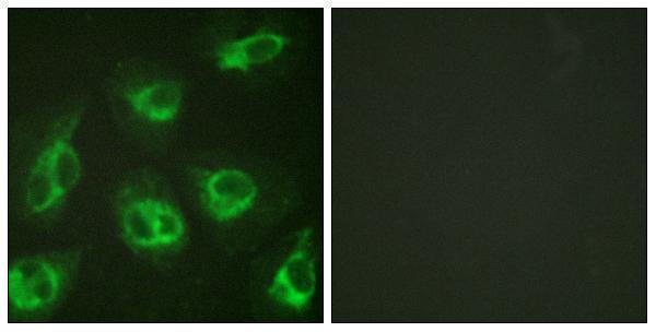 a03700 kcnip3 primary antibodies if testing 1
