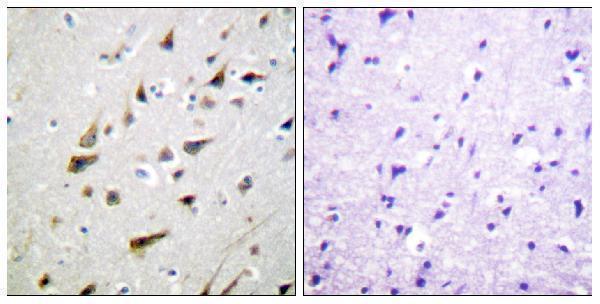 a03700 kcnip3 primary antibodies ihc testing 5