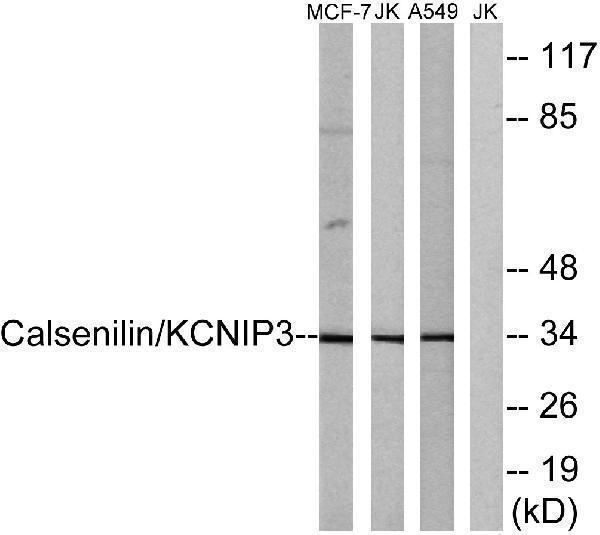 a03700 kcnip3 primary antibodies wb testing 4