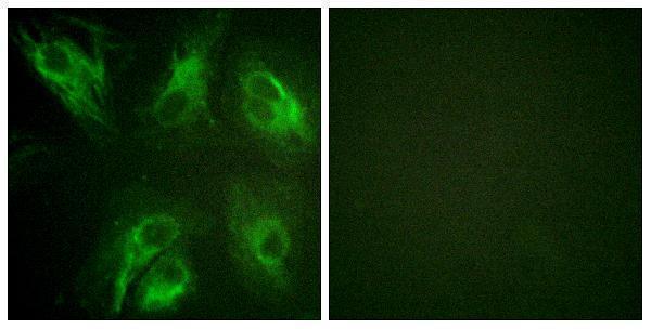 a03700s63 kcnip3 primary antibodies if testing 1